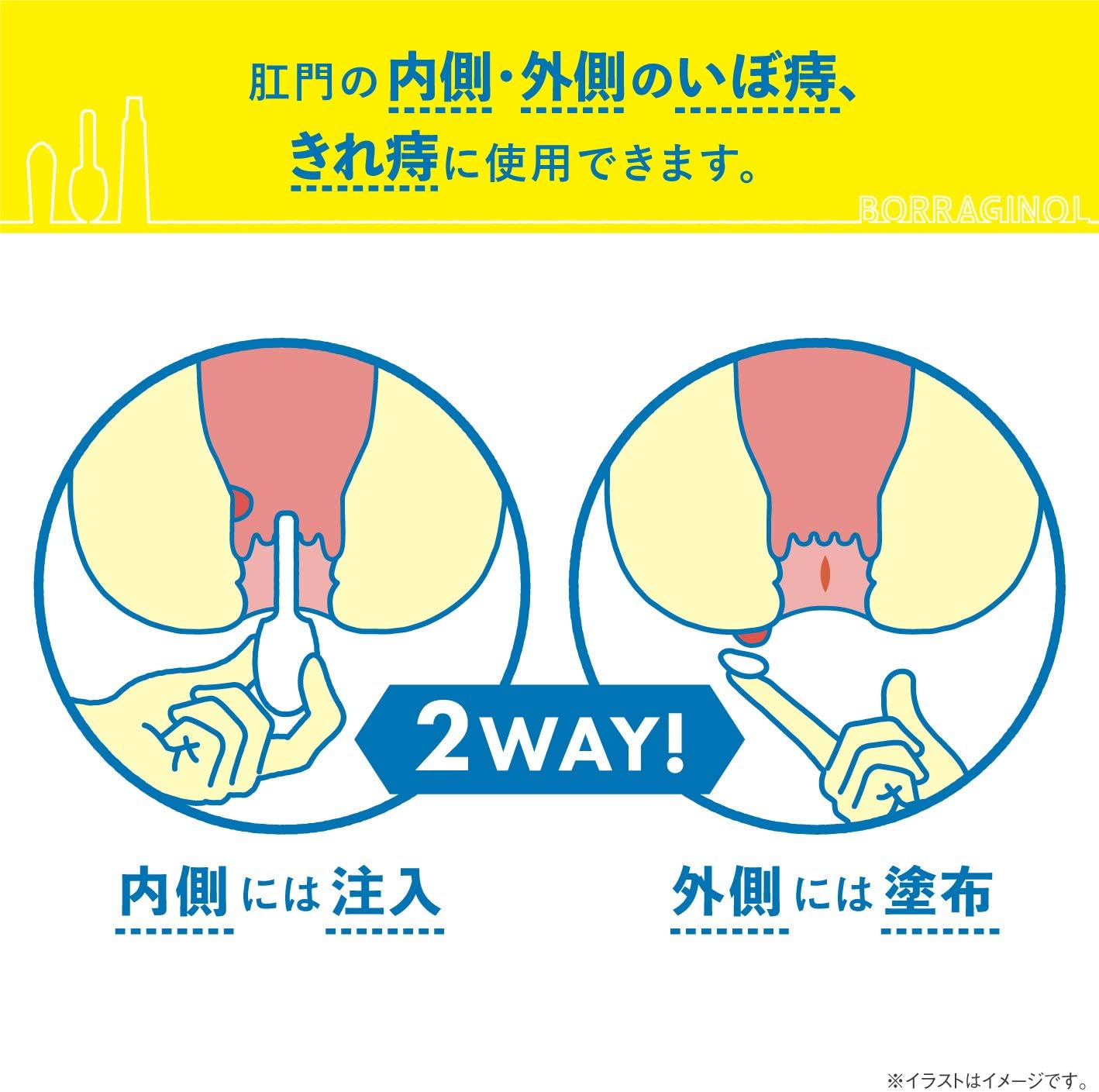 보라기놀 A 주입 연고 2g×10개