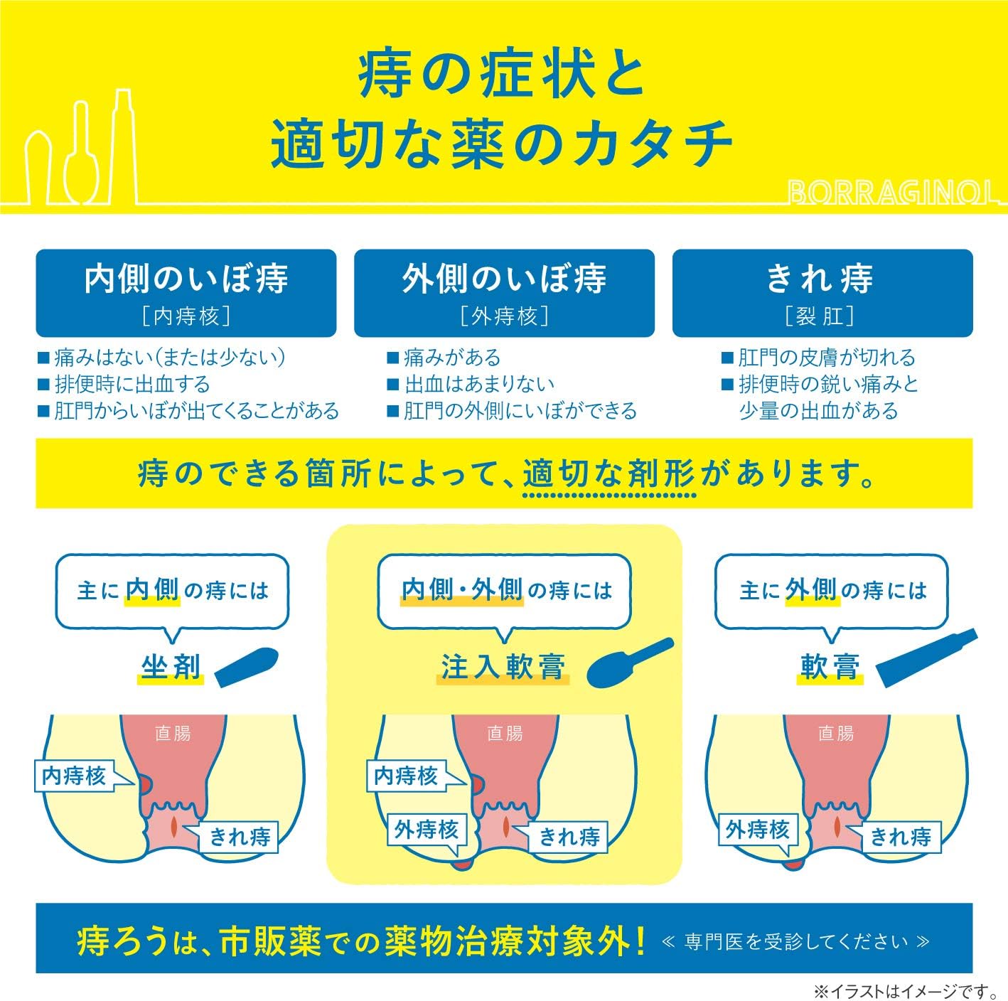 보라기놀 A 주입 연고 2g×10개